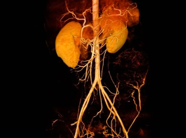 What Is Dihydroberberine and How Can It Improve Health for Diabetes?