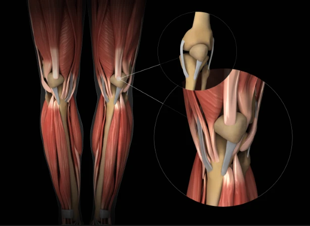 How BPC 157 Works in Tendon and Ligament Healing